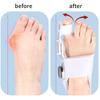 Bunion Corrector Unisex Adjustable Rotatable Toe Separator Hallux Valgus Braces Foot Straightener Pedicure Corrector