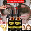 5ML/15ML/30ML/50ML/sérum na rast vlasov Produkt starostlivosti o vlasy Vlasové sérum na rýchle vlasy