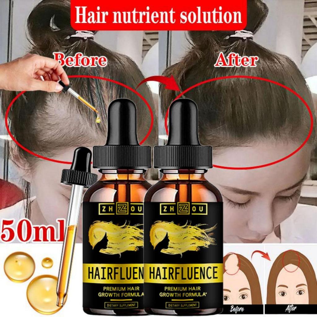 5ML/15ML/30ML/50ML/sérum na rast vlasov Produkt starostlivosti o vlasy Vlasové sérum na rýchle vlasy