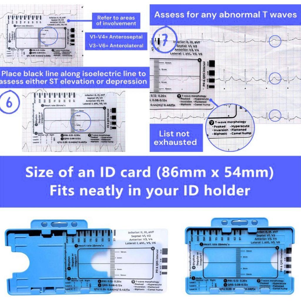 Plastic Electrocardiogram 7 Step Ruler Card For Precise Measurements Quick Assessments Hospitals Clinics Educational Use