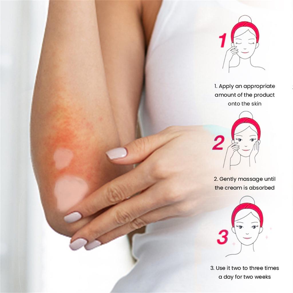 Calamine Detoxifying Cream 20g, Anti-itching Skin Care Cream