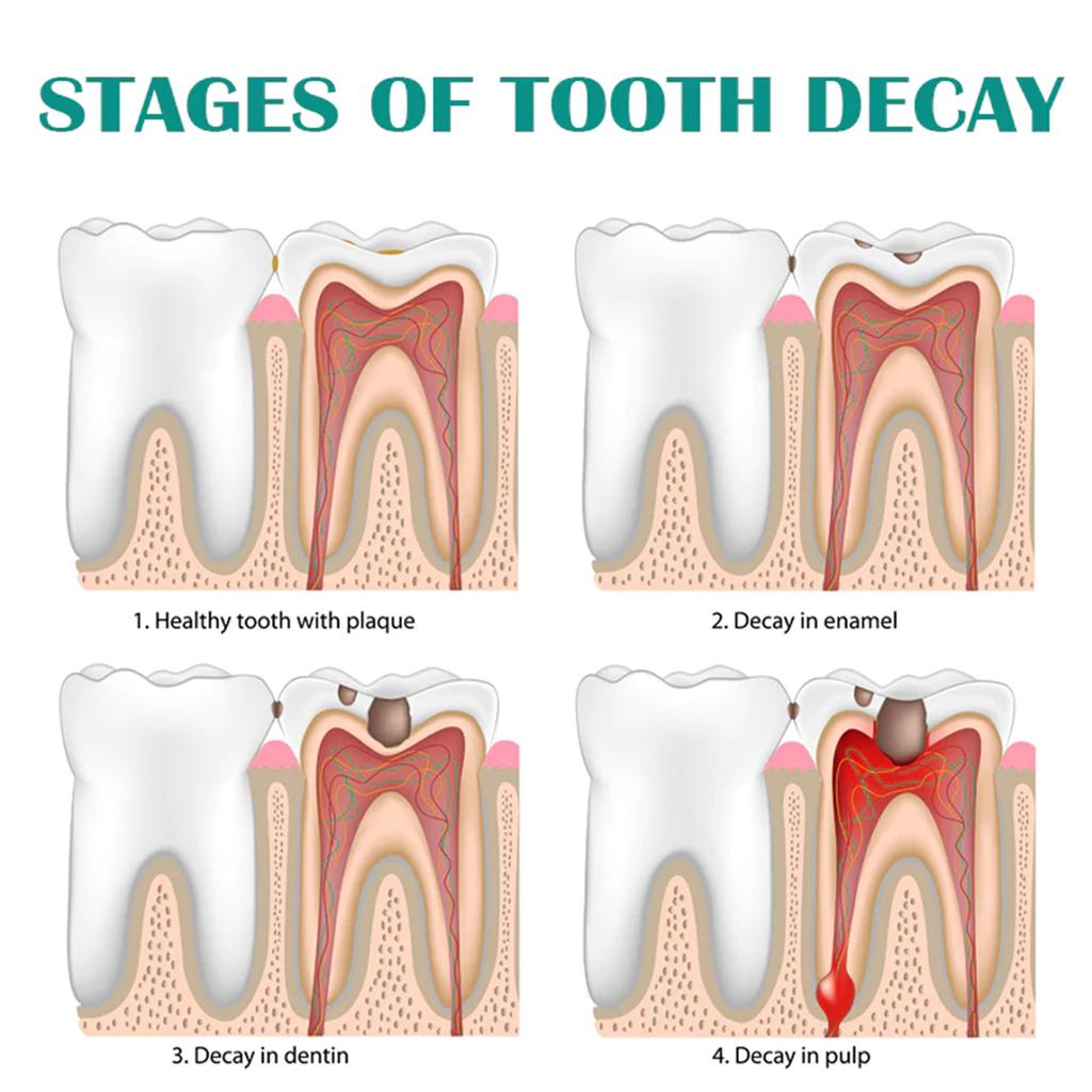 EELHOE Oczyszczanie zębów pianka wybielająca dokładne czyszczenie pasta do zębów piankowa pasta do zębów usuwa plamy świeży oddech narzędzia do pielęgnacji zębów 30ml