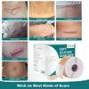 Silicone Scar Sheets (1.6"x 158" Roll-4M), Silicone Scar Tape for Scar Removal Treatment, Reusable Silicone Scar Strips for C-Section, Keloid, Burn,