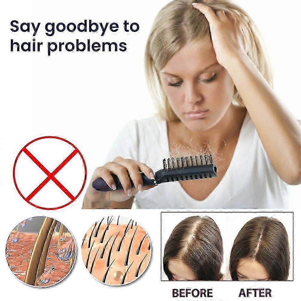 3Pcs Hair Growth Serum Spray For Women & Men Hair Growth Scalp Treatment