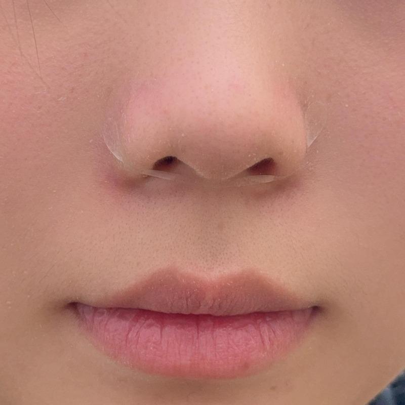 5/50pcs Shrinking Nose Wing Patch Wing Stickers Cosplay Nose Strips Invisible Slimming Thin Facial Shapers Care Makeup Tools