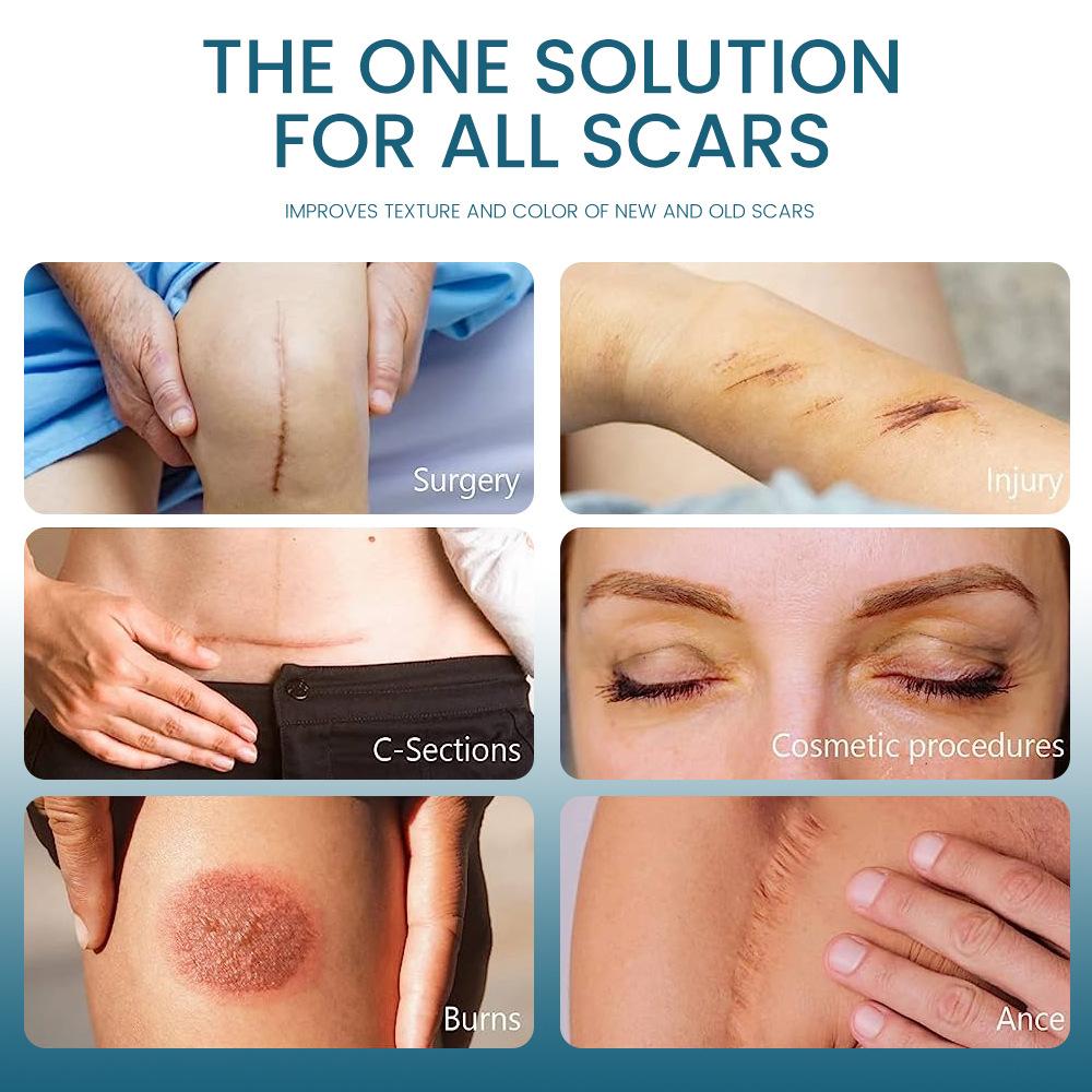 Pastă delicată pentru îndepărtarea cicatricilor și tratează arsurile, repararea cicatricilor, diminuarea gelului pentru cicatrici, pastă pentru reducerea cicatricilor pentru toate tipurile de piele