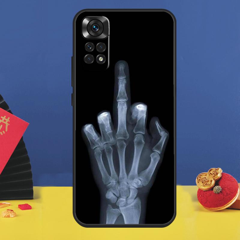 Skeleton Middle Finger Phone Case For Xiaomi Redmi Note 14 Pro 12 11 9 10 13 15 Pro Plus 10C 12C 13C 14C 15C Cover
