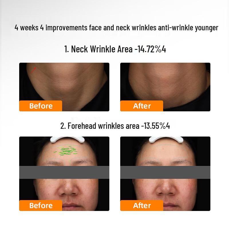 Zhan Mei Ya TieGu Pro Anti-Wrinkle & Firming Cream 15g