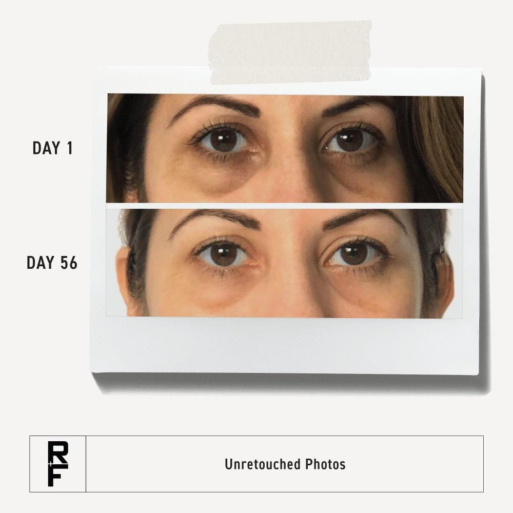 Rodan + Fields Active Hydration Bright Eye Complex 0.5 Oz