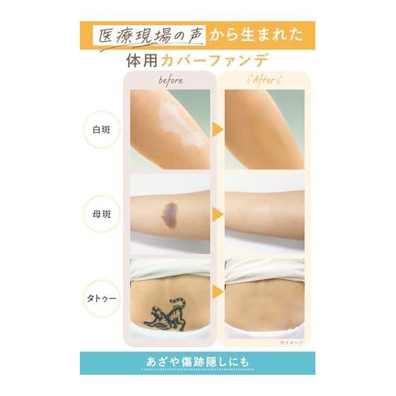 [Official] <Tattoo Hide Birthmarks/Scars> Marshfield SC Body Cover Foundation N Body Foundation 10 Colors 40g Body Vitiligo Pigmentation Cover