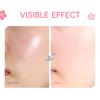 Laikou Sakura 8-Piece Skincare Set - New & In Stock