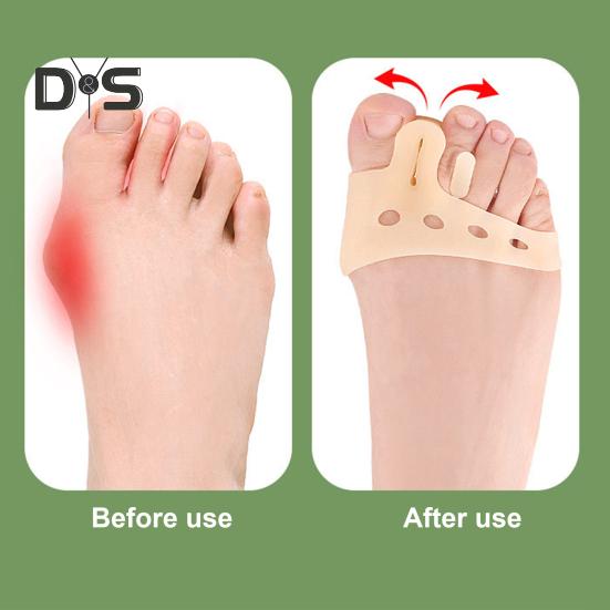 1 Paar Zehentrenner aus Silikon für Frauen, Zehenspreizer, Pads zur Linderung von Fußschmerzen bei Ballenzehen, Plantarfasziitis, atmungsaktiv, rutschfest, unterstützend, für den Ballen