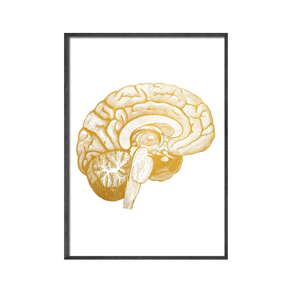 

Суставы рук диаграммы анатомии патологии плакат холст картины мозга настенные рисунки для медицинского образования кабинет врача класс 21x30cm No Framed