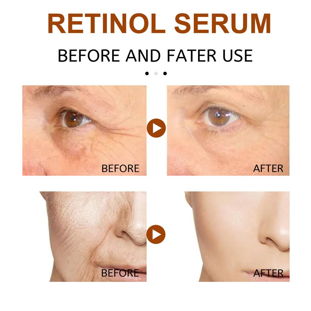 EELHOE Retinol Face Serum Gentle Moisturizing Hydrating Pore Diminishing Facial Serum