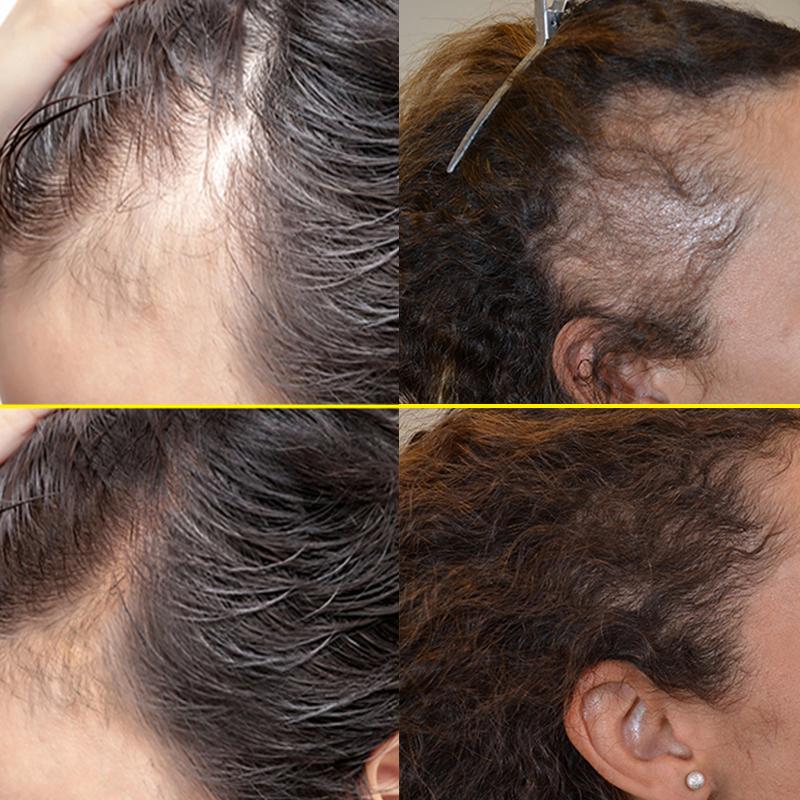 Poudre d'ombre à cheveux imperméable, poudre de contrôle des bords de ligne de cheveux, ombre de racine, maquillage, correcteur de cheveux