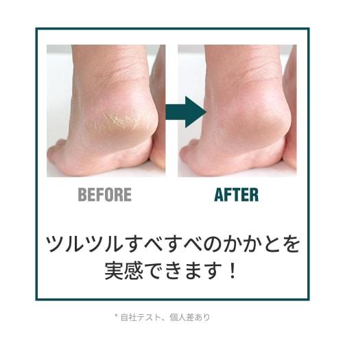 DASHU Naturally Derived AHA Foot Cream, Exfoliating, Smoothing, Heel Care, Moisturizing