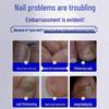 Jingpeitang Onychomycosis Nail Repair Solution