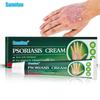Herbal Ointment Anti-itch Skin Care Plaster Cream Gently Nourishes The Skin and Smoothes The Skin