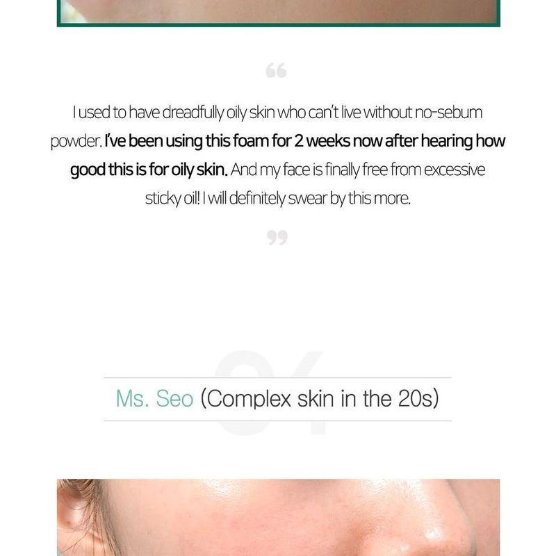 SOME BY MI - AHA,BHA,PHA 30 Days Miracle Acne Clear Foam Mini