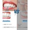 Dentellea Custom Mouthpieces, Set of 2, Upper and Lower, Transparent, Thin, Available In 1mm, 1.5mm, and 2mm, Comfortable, Unisex, Case Included