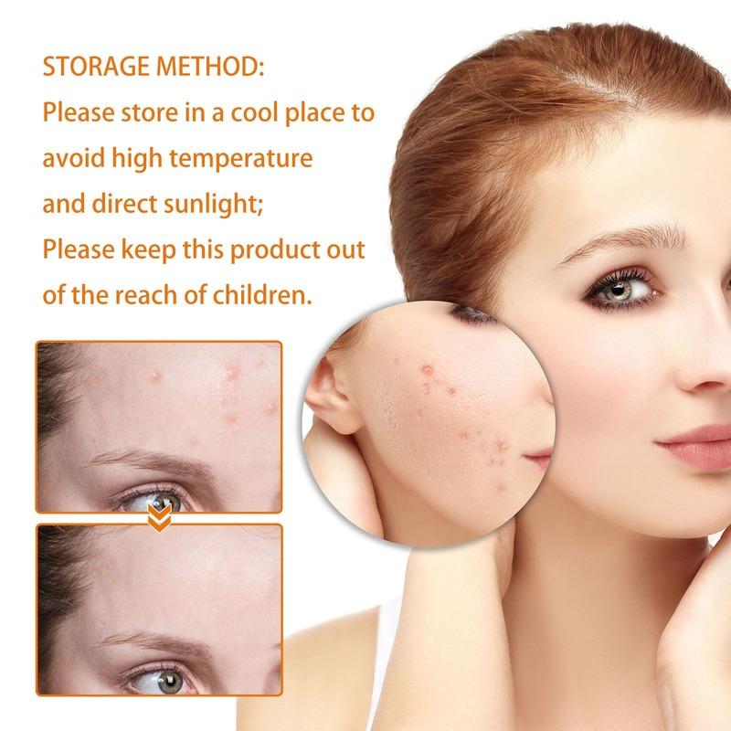 Vitamin C face cream moisturizes the face, desalinates acne marks and spots, and brightens, moisturizes and repairs the skin