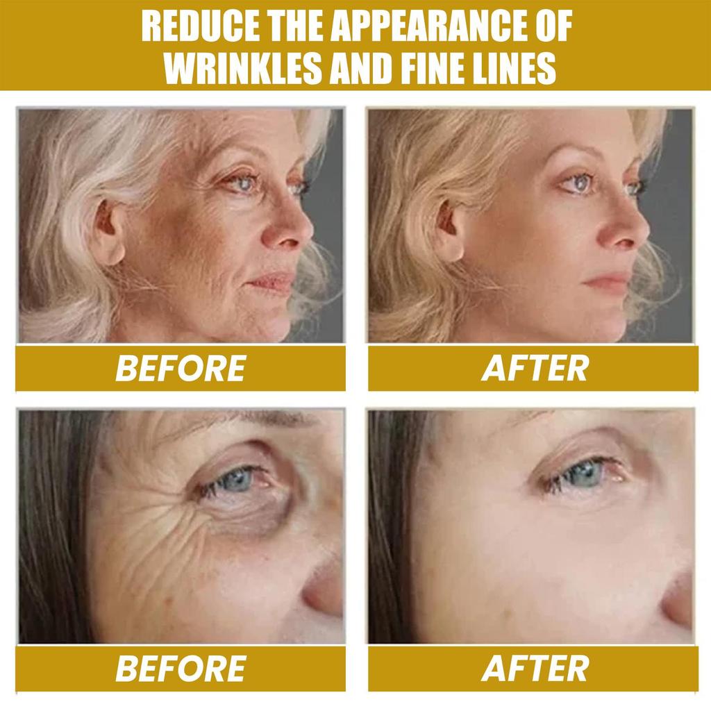 Multi-Benefit Bee Venom Cream - Anti-Aging, Fades Wrinkles/Nasolabial Folds, Hydrating & Brightening