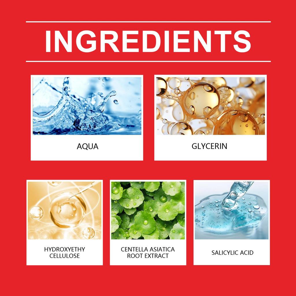 Jaysuing Acne Patches: Top-quality Hydrogel Acne Patches Designed Specifically To Reduce Acne and Whiteheads, 200 Pieces.