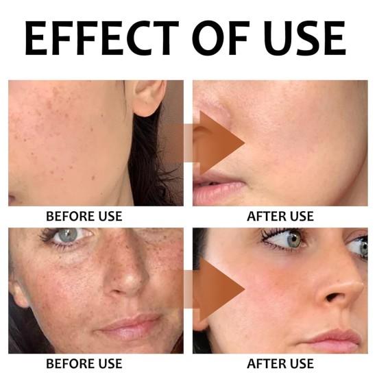 Turmeric & Kojic Acid Face & Body Soap, 3 Pack, Natural Ingredients with Lemon