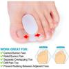 10 Pack Toe Spacers Separators, Bunion Corrector Gel Orthotics (1/2'' Thick) for Bunion, Overlapping Toes - L Size