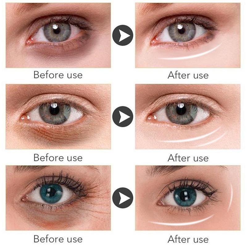 Nicotinamide Eye Cream Moisturizing Hyaluronic Acid Serum Anti Wrinkle Firming Improve Eye Bags AndDark Circles Skin Care