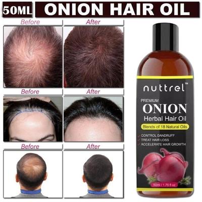 Nuttrel Onion and Black Seed Oil 50ml | For Hair Growth With Red Onion Extract And Essential Ingredients