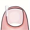 50/100Pcs Ingrown Toenail Tools C-shaped Tube Pad Foot Care Toe Nail Invisible Groove Clip