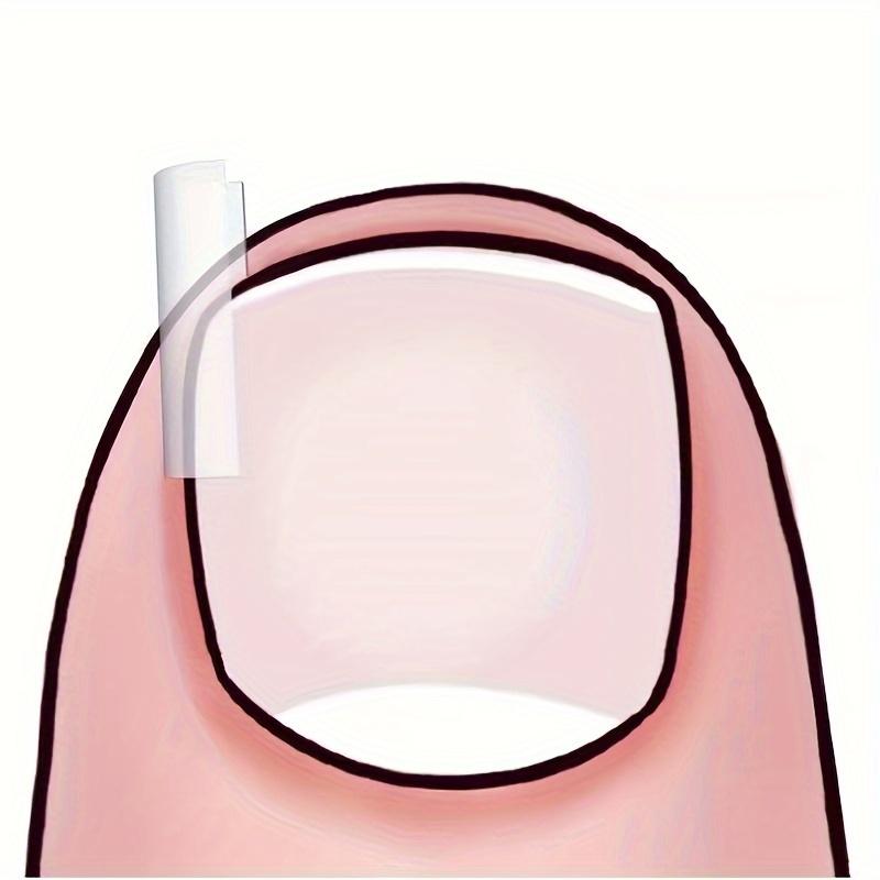 50/100Pcs Ingrown Toenail Tools C-shaped Tube Pad Foot Care Toe Nail Invisible Groove Clip