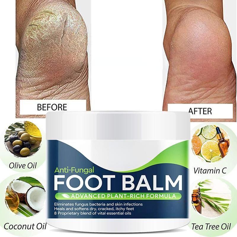 

Foot Cure All-Natural Plant Foot Balm – увлажняющий крем для ухода за ногами для сухой кожи 5G