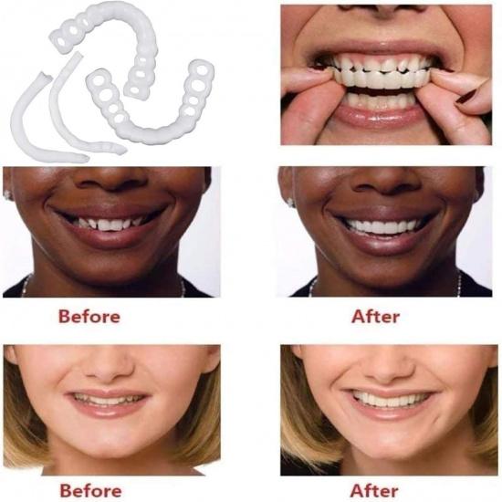 2 Paia, Naturale e Confortevole Ritrova Fiducia Sorriso, Regolabile Temporaneamente per Uomini e Donne(bianca)