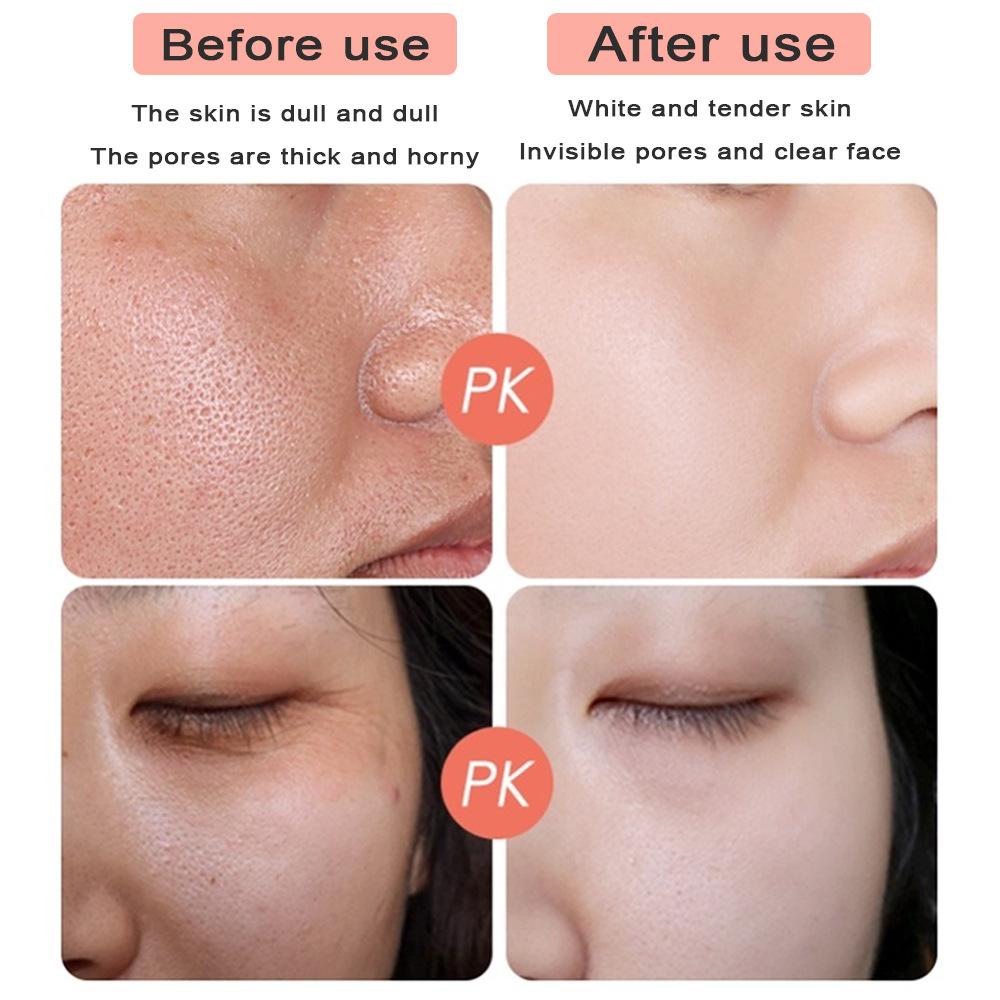 Nejnovější pleťová péče proti vráskám proti vráskám Liftingový krém na obličej Kolagen proti stárnutí vrásek