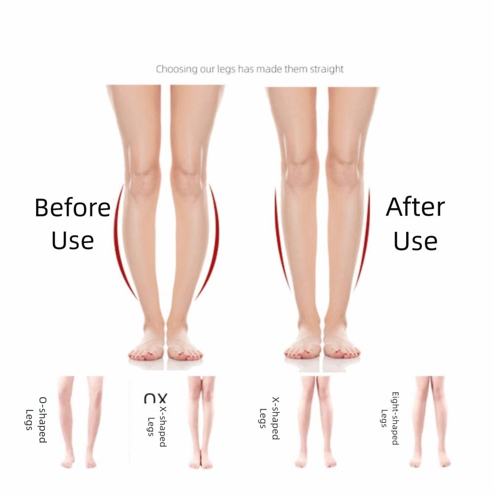 NEW Silicone Shoe Inserts Non-slip O/X Type Leg Corrective Insoles Arch Support Soft Heel Wedge Men Women