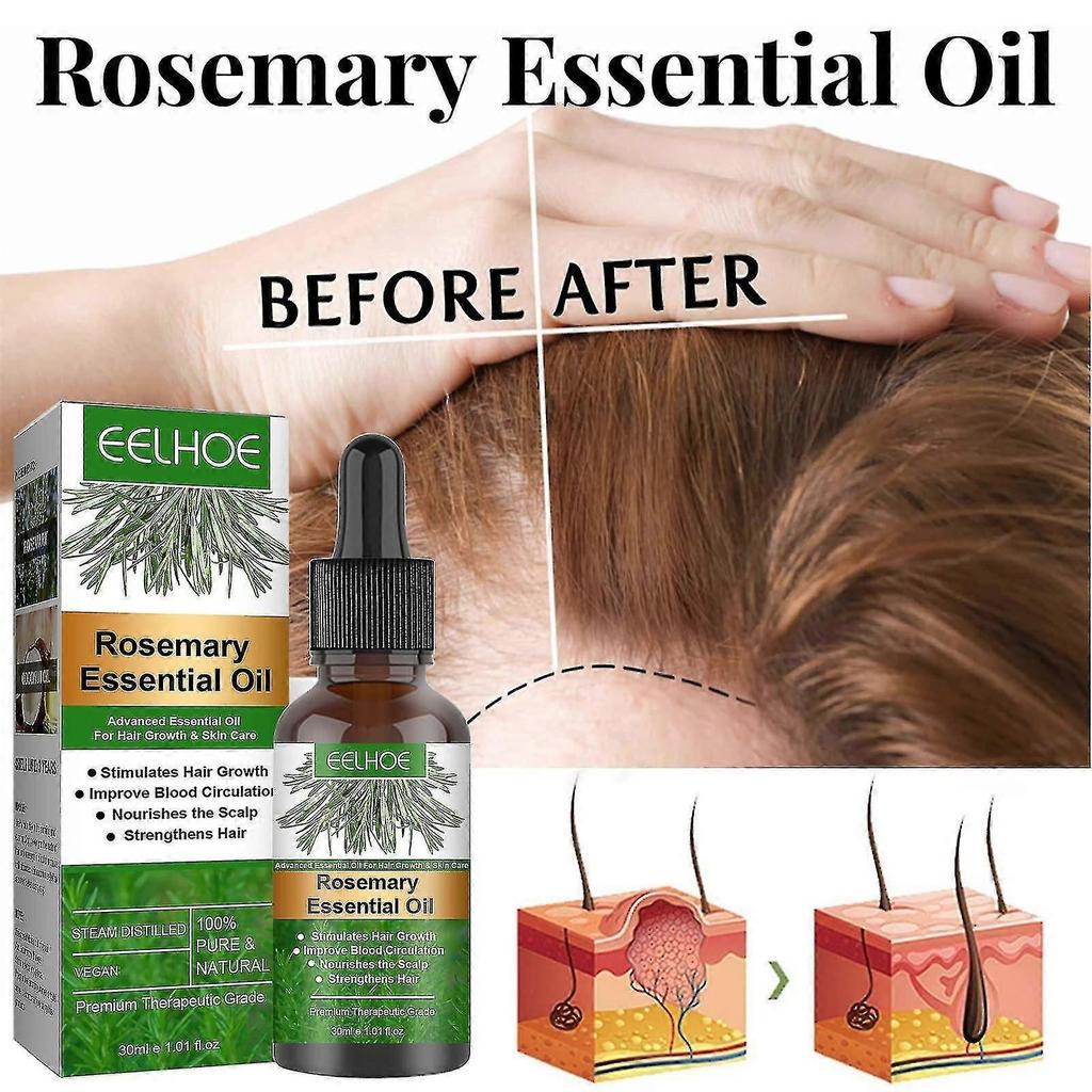 2PCS Rosemary Oil For Hair Growth, Rosemary Essential Oil For Hair Growth & Skin Care, Improve Hair Loss And Nourishes