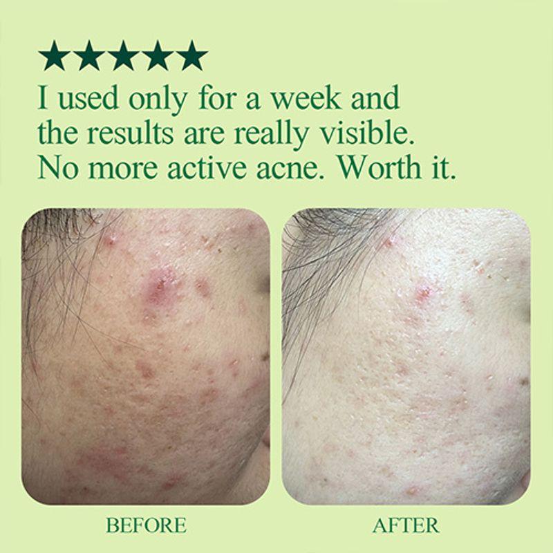 Pyunkang Yul Ultimate Calming Solution Toner 110ml