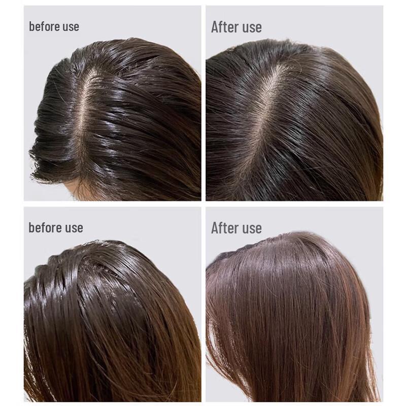 L'Oréal Paris Anti-Dandruff & Nourishing Essential Oil Shampoo