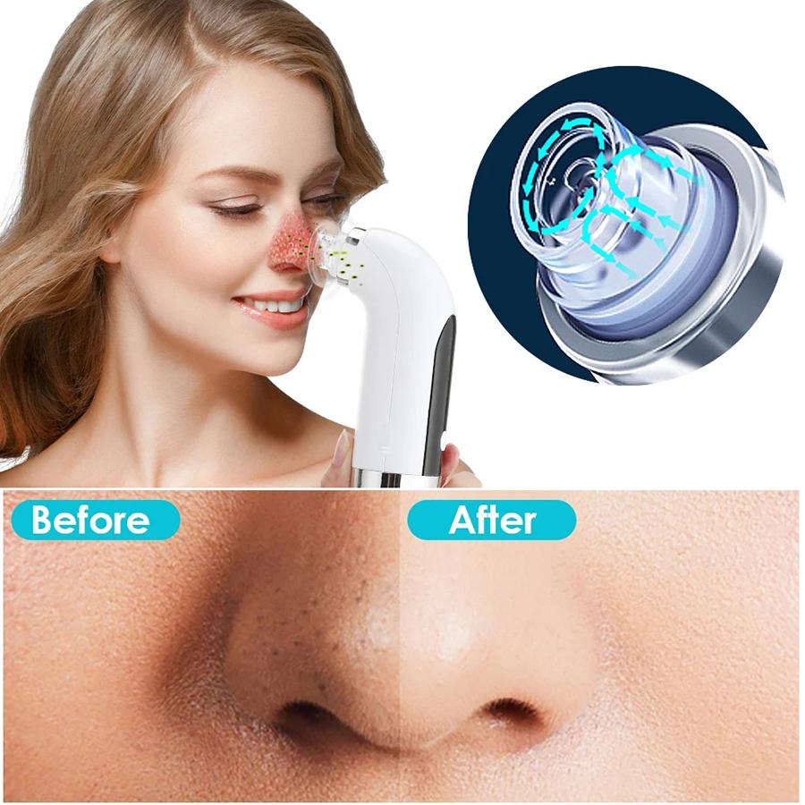 1PC Blackhead Remover Pore Vacuum Face Cleaner Electric Pimple Black Head Removal Rechargeable Water Cycle Facial Cleaning Tool