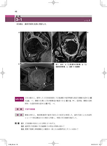 Imaging Diagnosis of Gynecological Diseases Learned from Case Studies