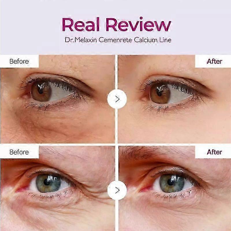 3X Dr.Melaxin Cemenrete Calcium Volume Multi Baume Stick Cœur Rides K-beauty