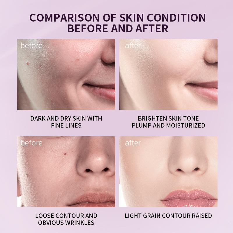 MERCILEN Moisturizing Lotion Polypeptide Condensation Triple Firming Emulsion Moisturizing Firming and Diminishing Fine Lines Facial Essence Emulsion