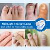 Convenient UV Remove Nail Fungus Lamp Fast-acting Killingnail Fungus Mini Lamp  Auxiliary Tool