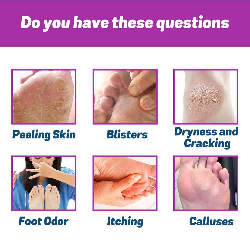 Ximonth Foot Care Spray Refreshing Odor Eliminating Formula For Sweaty Feet And Itch Relief