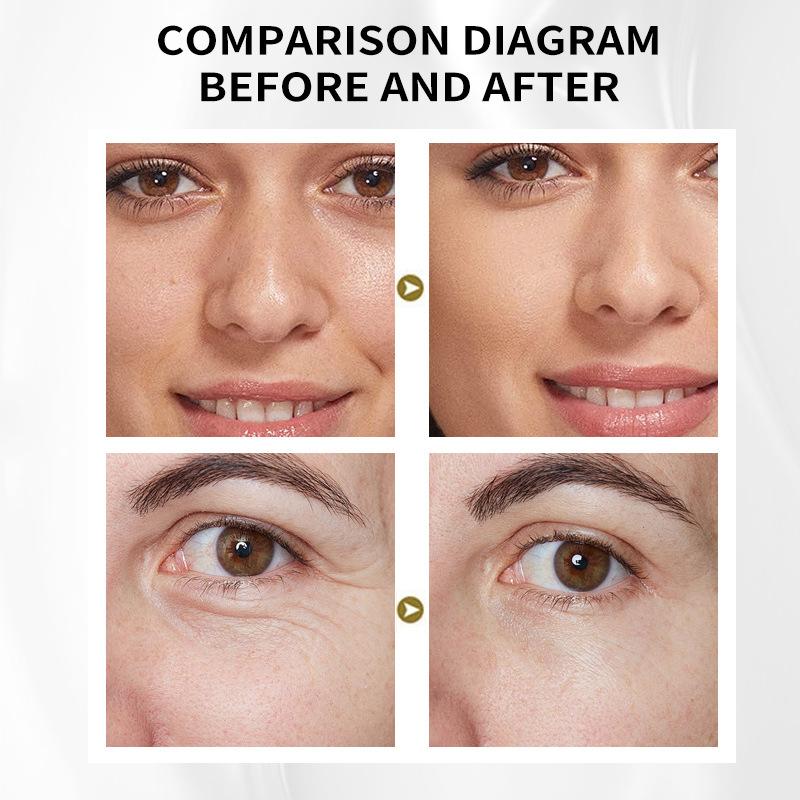 English Tretinoin Emulsion Essence Lotion Moisturizing Moisture Replenishing Face Cream San Skincare Products