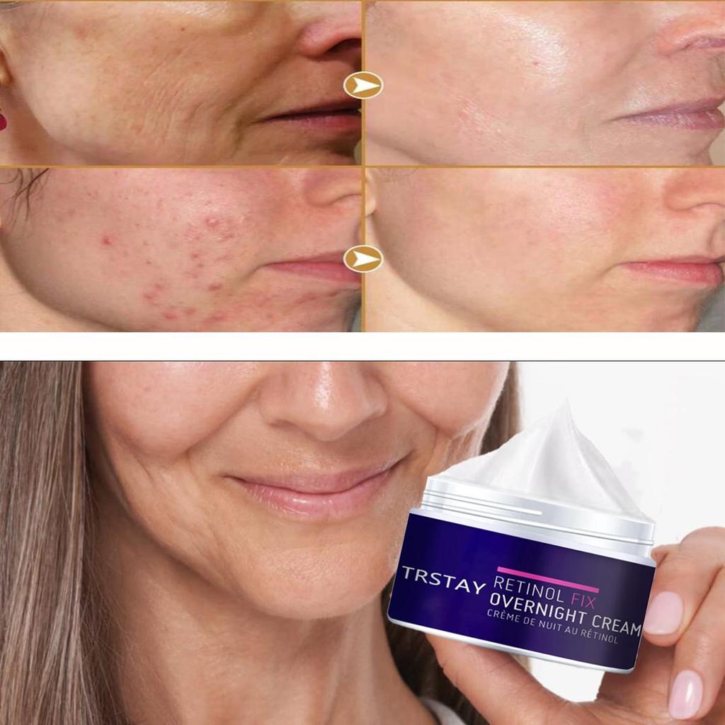 Whitening and Brightening Skin Night Cream, Night Cream Retinol, Firming Skin, Even Skin Tone, Nourishing and Moisturizing Cream