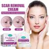 Ouhoe Scar Care Cream For Smoothing And Moisturizing Skin With Gentle Formula