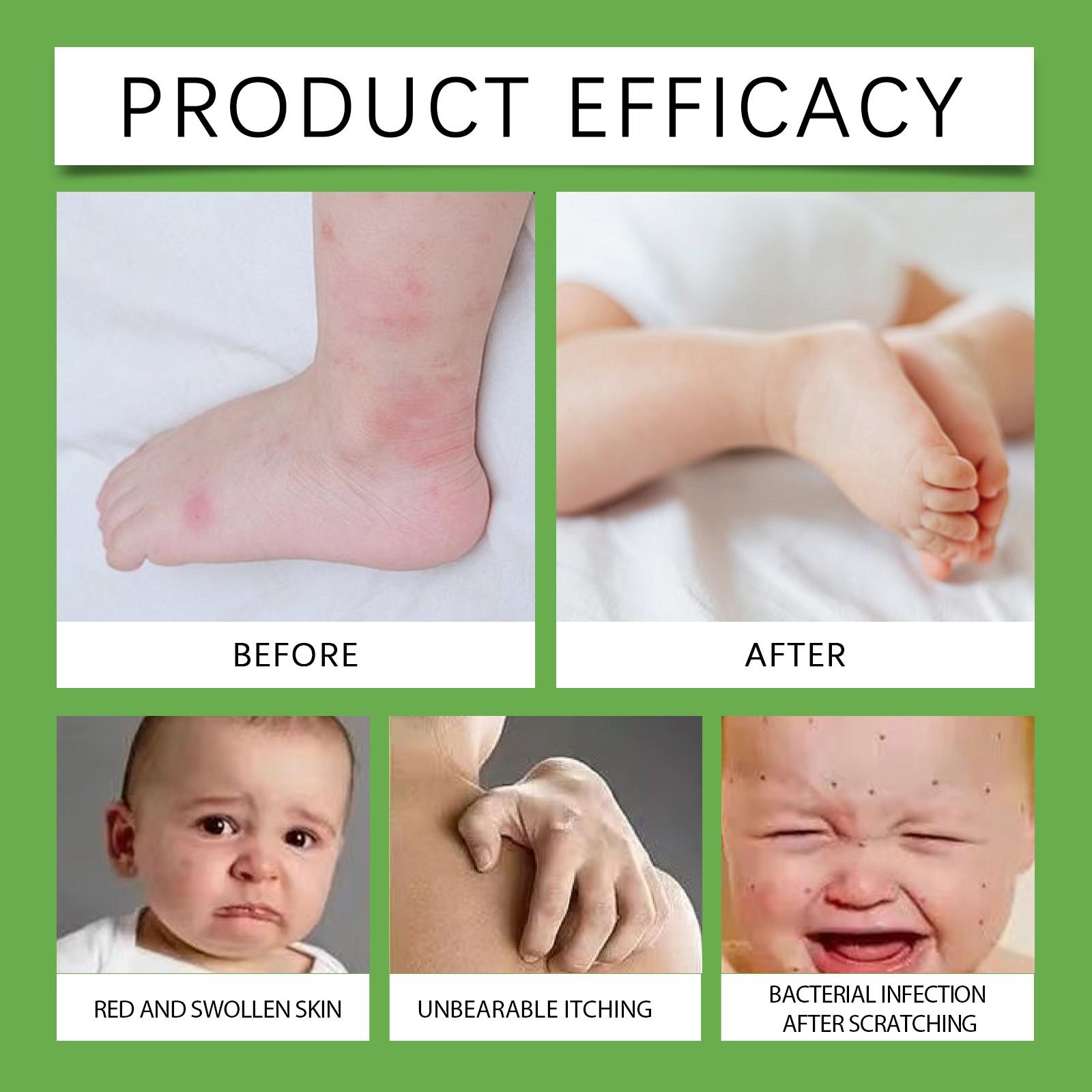 Защитный летний спрей Растительное масло для улицы Антимоскитный спрей Противомоскитные — фото 8